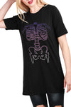 Clare X-Ray Skeleton Bone Tunic T Shirt Dress